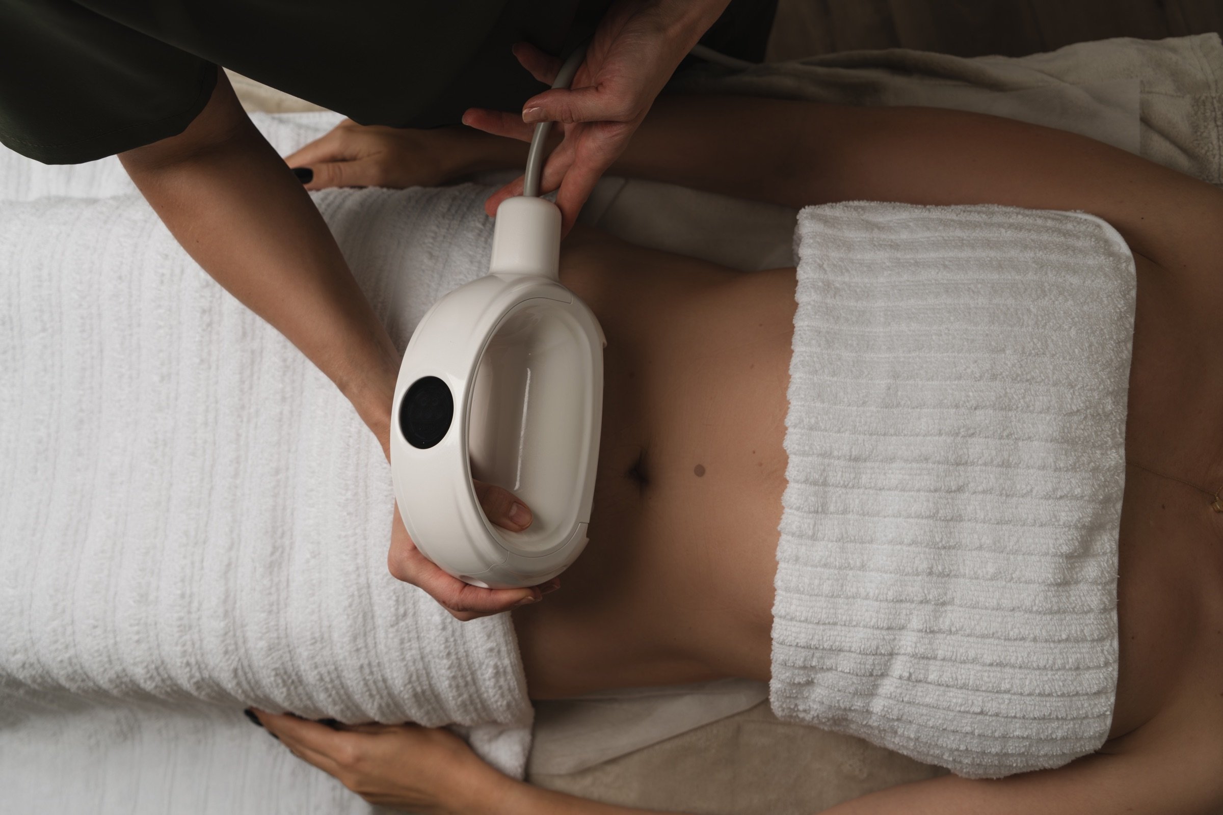 The sphere handpiece applied to the abdomen during a body contouring session
